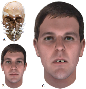 Reconstruction Overview